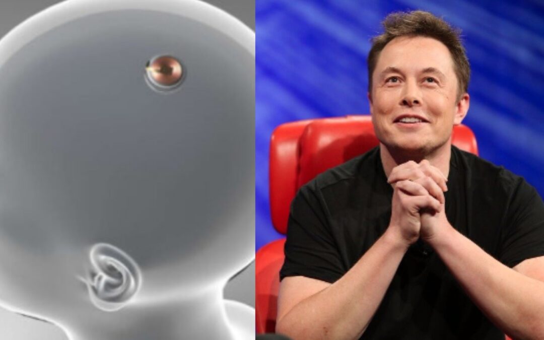 Elon Musk confirmó que su compañía ya implantó un chip cerebral en el primer ser humano